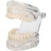 Transparent Acrylic Tooth Model - Dental Teaching Tool for Simulation & Pathological Repair | International Shipping - Buy Online on GoSupps.com
