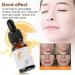 Natudeco 10ml Vitamin C Serum Whitening Face Essence Moisturizing Serum Skin Care Treatment for Facial Firming Hydrating Whitening Skin Dark Spot Remover - Buy Online on GoSupps.com