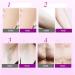 AYBO Hair Removal Spray Mousse - Pain-Free & Anti-Allergic Foam for Men & Women | No Damage Depilatory Cream - Buy Online on GoSupps.com