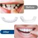 Buy Brigtviee 2 Pairs of False Teeth Veneers - Temporary Cosmetic Tooth Covers for Men & Women - Buy Online on GoSupps.com