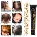 Hocossy Regrowth Organic Hair Serum Roller Set - Scalp Intense Hair Growth Treatment for Men & Women 20ml 3PCs - Natural Hair Care Solution - Buy Online on GoSupps.com