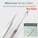 DBAILY Tweezers Set of 6 Tweezers Set Splitter Tweezers Tweezers Pointed for All Light Precision Works Pimple Squeezing Tool and Comedone Squeezer for All Skin Types - Buy Online on GoSupps.com