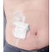 Waterproof Shower Cover Shields for Dialysis Port & Catheters - 25 Pack Shower Protector for Picc Line Chemo Port Feeding Tube & G-Tube Patients - Buy Online on GoSupps.com