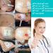Split Drain Adhesive Bandages 4x4 for PD Catheter & Feeding Tube - Pack of 10 - Buy Online on GoSupps.com