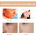 Advanced Sunscreen Spf 50 Face Water Resistant & Non Greasy Face Sunscreen for Body No Fragrance UVA & UVB Protection Suitable for Outdoor Travel Tanning - Buy Online on GoSupps.com