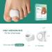 Welnove Toe Separator - Bunions Relief & Hammer Toe Corrector - Medium Size Toe Spacers for Overlapping Toes - Buy Online on GoSupps.com