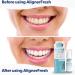 EverSmile AlignerFresh Extra Whitening Foam - Aligner Cleaner & Retainer Whitener - Buy Online on GoSupps.com