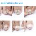 Ingrown Toenail Treatment Kit for Pain Relief - Paronychia Corrector Tool Set for Salon and Home Use - Buy Online on GoSupps.com