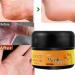 AllbestAye Foot Repair Cream - Heal Cracked Heels & Dry Feet | Moisturizing Callus Care for Soft Skin - 50g - Buy Online on GoSupps.com