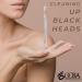 OCBA Blackhead Remover Professional Skincare Spot Treatment Blackhead Remover Tool for Blemish Comedone Whiteheads Pimple Popper with Double Sided Soft Touch and Anti-Slip Design - Buy Online on GoSupps.com