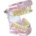 Buy Liusu Children's Tooth Theory Dental Model - Transparent Implant & Orthodontic Demo Model with Self-Ligating Clips | International Shipping Available - Buy Online on GoSupps.com