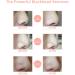 Blackhead Remover Pore Vacuum with Camera - Acne Extractor, Hot Compress, WiFi HD Camera, 4 Probes, 3 Adjustable Suction, USB Rechargeable | Suitable for All Skin Types - Buy Online on GoSupps.com