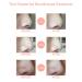 Blackhead Remover Pore Vacuum with Camera - WiFi HD Acne Extractor with Hot Compress, 4 Probes, 3 Suction Levels - USB Rechargeable - Gold - Buy Online on GoSupps.com
