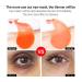 30 Pairs Collagen Under Eye Mask Patches - Reduce Puffy Eyes, Dark Circles & Wrinkles - Moisturizing Eye Treatment for Brighter Skin - Vitamin C Infused - Buy Online on GoSupps.com