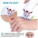 Benkeg Blackhead Remover - Electric Blackhead Suction Device with 5 in 1 Pimple Zit Comedone Extractor Tool Acne Removal kit Blackhead Remover Household Face Pore Cleaner Cosmetic Instrument White with 5pcs needles - Buy Online on GoSupps.com