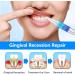 Remove Oral Gum Treatment Gel - Tooth Elevator Essence Pin & Protection - 3 PCs for Gum Residue Stains & Tartar Removal - Buy Online on GoSupps.com