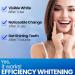Teeth Whitening Kit-Teeth Whitening 28 Teeth Whitening Strips 14 Sets Teeth Whitener for Teeth Whitening (Mint-14 Sets) - Buy Online on GoSupps.com