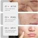 Friut Acid Face Serum for Acne Mark Salicylic Acid Anti Wrinkle Serum Fade Ance Mark & Shrink Pore Face Serum Hyaluronic Acid Acne Repair Serum for Sensitive Skin Smoothing Hyaluronic Serum-30ml - Buy Online on GoSupps.com