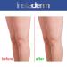Vitamin K Cream with Arnica for Bruises, Spider Veins & Dark Circles - Moisturizer for Fine Lines, Puffiness & Wrinkles - Face & Body Repair - Buy Online on GoSupps.com