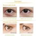 Silicone Eye Patch Combo Set Reusable Wrinkle Facial Forehead Facial Patch Removal Sticker Pad Eye - Buy Online on GoSupps.com