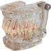 Buy DYTAH Transparent Teeth Model - Removable Pathological Tooth for Dental Training & Examination | International Shipping - Buy Online on GoSupps.com