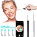 HD Smart Visible Lighting Ear Cleaner - Wireless Portable Earpick Endoscope for Earwax Removal | White+Black, Free Size - Buy Online on GoSupps.com