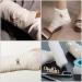 Elastic Bandage Clips - 100pcs Stretch Metal Clasps for Secure Bandage Fixing | Replaceable Wrap Fasteners - Buy Online on GoSupps.com
