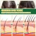 S Rum De Croissance Des Cheveux Au Ginseng En Spray Pour Hommes Et Femmes S Rum De Repousse Des Cheveux Au Gingembre Pour La Perte De Cheveux L' Claircissement Des Cheveux (3pcs) - Buy Online on GoSupps.com