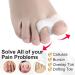 2/4/10 Pcs Gel Bunion Corrector & Toe Separator Protector - Comfortable Bunionette & Hammer Toe Pads - Buy Online on GoSupps.com