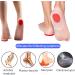 AMTAM 4 Pairs of Gel Heel Cups Shoe Inserts for Plantar Fasciitis Heel Protector Cups for Plantar Fasciitis Support Heel Spur Relief Inserts for Achilles Pain Relief Fascia Support Sore Feet-Red - Buy Online on GoSupps.com