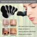 Nosestripes Blackheads Blackhead Nose Strips Deep Cleansing Clear-Up Strips 30 Pieces Nose Strips Pore Strips Anti Nose Stripes Blackheads Remove Blackheads and Impurities - Buy Online on GoSupps.com
