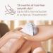 PHILIPS Lumea IPL Hair Removal Device w/ SmartSkin Sensor & Pen Trimmer - White - Buy Online on GoSupps.com