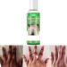 Extra Strong Peeling Oil Peeling Oil for Dark Skin Green Peeling Oil Exfoliating Peeling Solution for Hand Feet Chemical Peel for Face (110ML/3.88 Fl Oz)