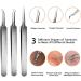 10Pcs Blackhead Remover Pimple Popper Tool Kit - Professional Acne Extractor for Nose & Face - Buy Online on GoSupps.com