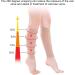 Calf Compression Stockings for Women & Men | Varicose Veins Relief | Elastic Leg Covers | Reduce Swelling & Discomfort - Buy Online on GoSupps.com