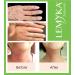 LEMYKA Eczema Flare Defense Calming Cream - 3 Pack Bundle | For Infants, Babies, Kids, & Adults with Atopic Dermatitis | Steroid-Free Formula - Buy Online on GoSupps.com
