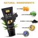 Charcoal Blackhead Remover Mask Kit with Brush and Extractors - Deep Cleansing for Face, Nose, Pores, Acne - Suitable for All Skin Types (3.5 Fl.oz) - Buy Online on GoSupps.com