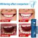 BBABBT Teeth Whitening Pen Professional Teeth Whitening Gel Natural Whitening Bleaching Treatments Effective Painless No Sensitivity3g - Buy Online on GoSupps.com