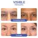 ANRUI 30g Big Eye Lifting Double Eyelid Cream for Men and Women (2PCS) - Buy Online on GoSupps.com