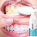 Allouli Teeth Mousse Foam Toothpaste | Teeth Whitening Stain Removal & Fresh Breath - Shop Now! - Buy Online on GoSupps.com