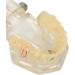 Buy Verdant Touch Transparent Dental Implant Model - Ideal Teaching Aid for Pathology & Dental Studies | International Shipping Available - Buy Online on GoSupps.com