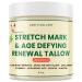 Grass Fed Beef Tallow Body Cream Whipped Tallow Cream Hydrating Moisturizer for Sensitive Skin Anti-aging Stretch Mark Cream For Men & Women 8 Fl Oz (8 fl oz Unscented) Unscented 8 Fl Oz (Pack of 1)