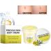 Stretch Mark Cream Pregnancy Stretch Mark Remover Moisturizing Maternity Cream Skin Tightening Cream Maternity Skin Care Increase Skin Elasticity Increase Skin Elasticity 100g - Buy Online on GoSupps.com