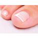 CurveCorrect Ingrown Toenail Home Treatment Kit with 10 Braces - Buy Online on GoSupps.com