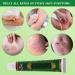 Buy Anti-Itch Cream | Herbal Antibacterial Eczema Treatment for Allergic Dermatitis - Ships Worldwide - Buy Online on GoSupps.com