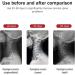 Neck Decompression Air Collar - Cervical Traction Device for Neck & Shoulder Pain Relief - Adjustable Traction Support - Buy Online on GoSupps.com