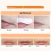  ZHJZGS Upper lip hair removal cream - Painless and gentle quick hair removal for the face and body for all skin types fast and easy (4PCS) - Buy Online on GoSupps.com