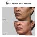 N.OVOLOGY Pro-Lift Cellular Restoration Serum Co-Created with Dermatologists 5.3% Pro-Retinol + Niacinamide + Adenosine + Tripeptide - Buy Online on GoSupps.com