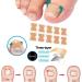 Ingrown Toenail Corrector Patch - 50PCS Natural Strips for Painless Treatment and Relief from Nail Groove - Glue-free Solution - Buy Online on GoSupps.com