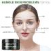 Rikivt Mud Mask - Glacial Clay & Charcoal Face Mask for Blackhead Removal - 4.8 oz - Buy Online on GoSupps.com